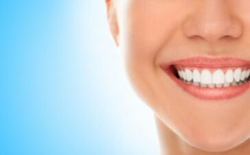 apinamiento-dental