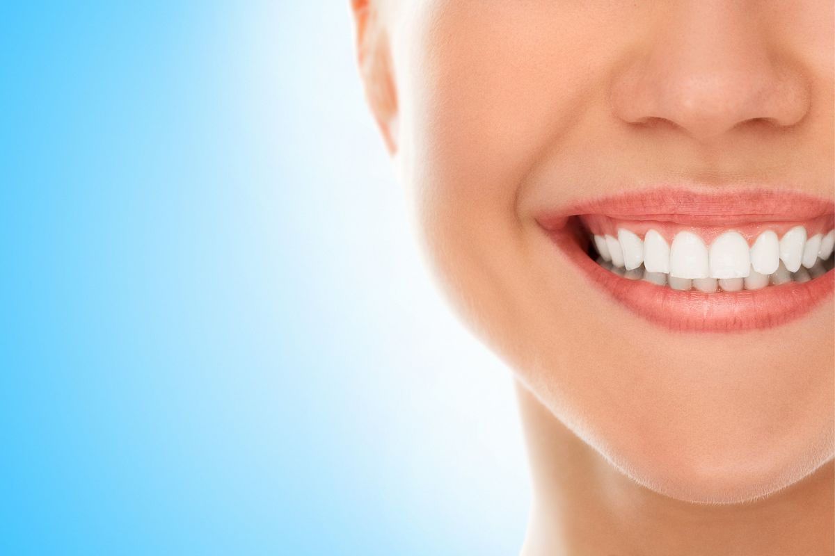 apinamiento-dental