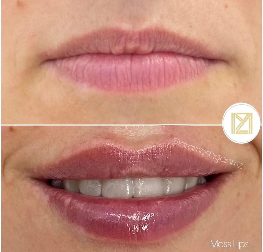 Medicina estética en Ibiza